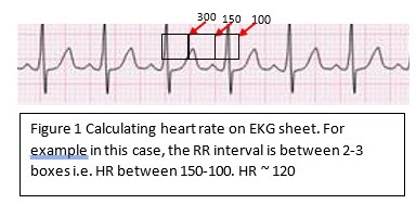 Calculating heart rate on EKG sheet, HR ~ 120