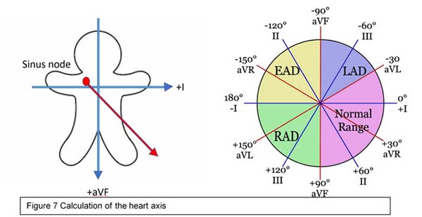 Calculation of the heart axis