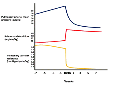 Pathophysiology Of Ventricular Septal Defect In Flow Chart