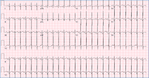 Cardiology