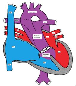 truncus arteriosus, with the main pulmonary from the common trunk