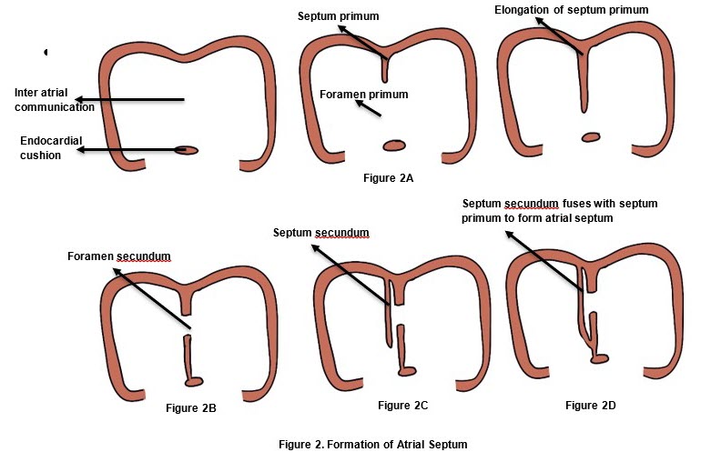 Formation of Atrian Septum